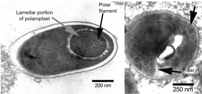Bào tử trùng Enterocytozoon hepatopenaei dưới kính hiển vi điện tử
