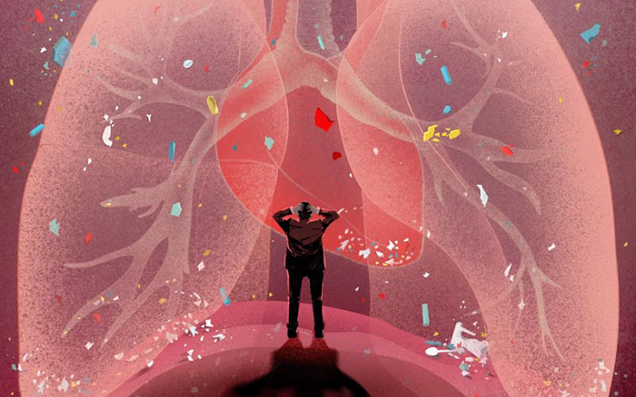 Tiếp xúc lâu dài với hạt nhựa có thể gây suy yếu hệ miễn dịch. Tiếp xúc lâu dài với hạt nhựa có thể gây suy yếu hệ miễn dịch.