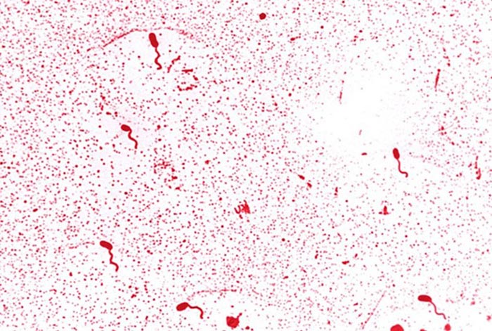 Tôm bị mòn đuôi báo hiệu điều gì? Biện pháp xử lý và phòng ngừa hiệu quả 3 Vibrio-mầm bệnh cơ hội trong ao tôm.