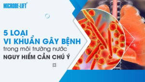 5 loại vi khuẩn gây bệnh trong môi trường nước nguy hiểm cần chú ý