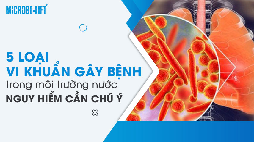 5 loại vi khuẩn gây bệnh trong môi trường nước nguy hiểm cần chú ý