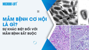 Mầm bệnh cơ hội là gì? Sự khác biệt đối với mầm bệnh bắt buộc